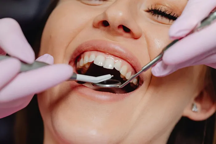Full Mouth Rehabilitation - Dr. Gilberto Viesca in Piedras Negras, Coahuila