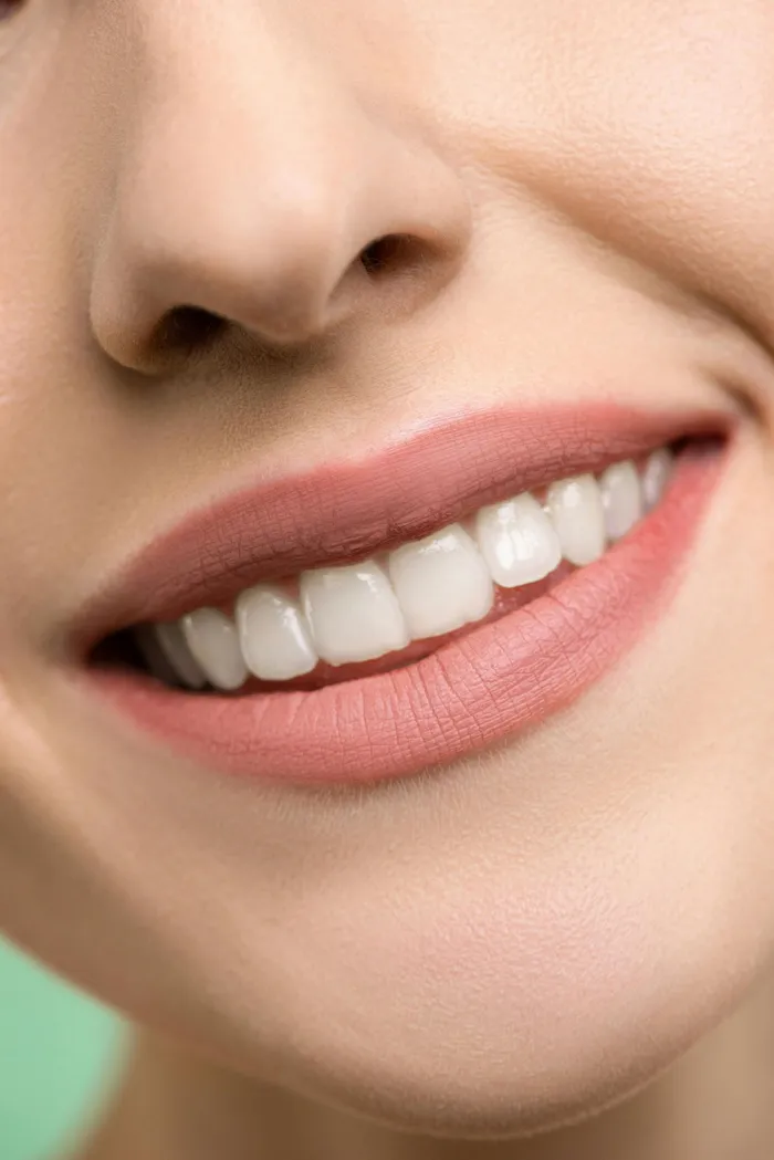 Professional Teeth Whitening - Dr. Gilberto Viesca in Piedras Negras, Coahuila