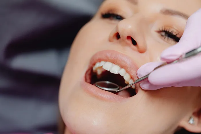 Cosmetic Dentistry - Dr. Gilberto Viesca in Piedras Negras, Coahuila